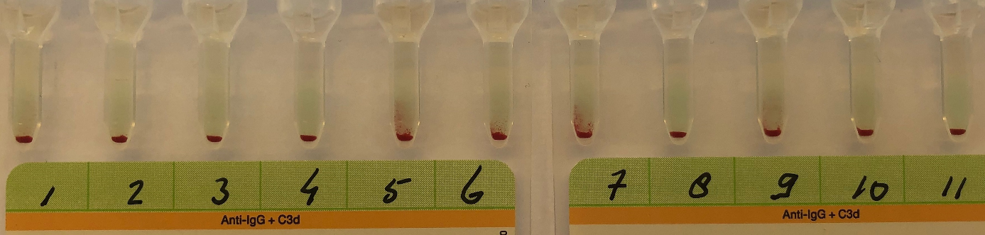 figuur (kleur) 11-cells panel met zwakpositieve reacties 