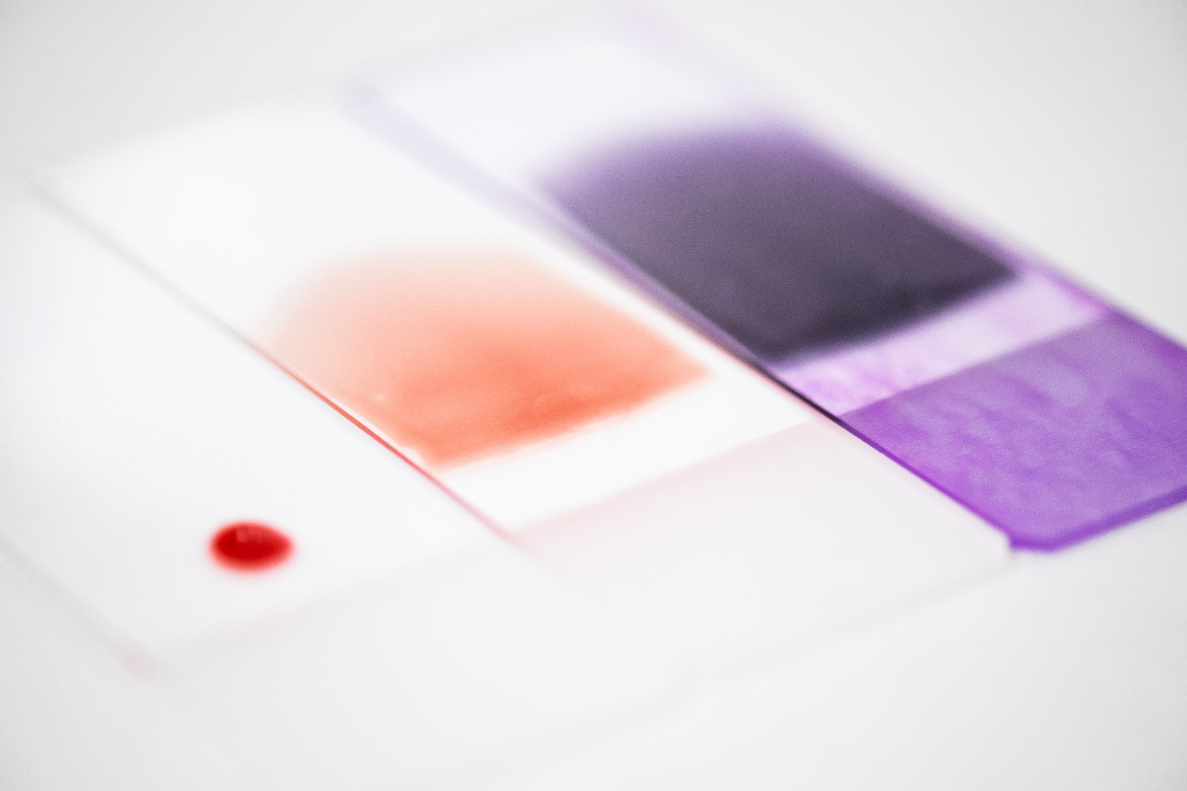 Foto (kleur) labmonsters klinisch-chemische en hematologische diagnostiek